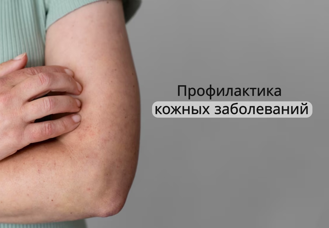 svcdz1m4hx5ttswvkscytm8dqctvs4huv2i9qhn75yl4pnu-loccobsp3zzzjos_PWSCT8u.jpg svcdz1m4hx5ttswvkscytm8dqctvs4huv2i9qhn75yl4pnu-loccobsp3zzzjos_PWSCT8u.jpg